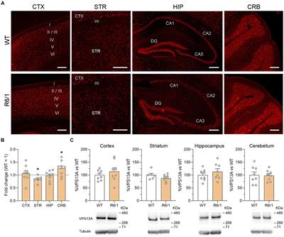 Preserved VPS13A distribution and expression in Huntington’s disease: divergent mechanisms of action for similar movement disorders?